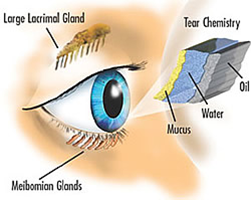 Dry Eye Treatment Diagram